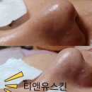 티앤유스킨