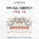 L&B치과의원 | 대구칠곡치과 상악동 거상술, 확인하셨나요?