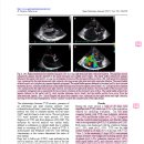 TVD와 관련된 clinical sign, MST 및 mortality와 관련된 risk factor 이미지