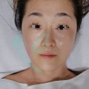 엔스킨 - 하남시 미사강변동로84번길 29 | 하남 미사역 에스테틱 엔스킨 하남미사점 윤곽 피부관리 솔직후기
