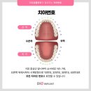 김플란트치과의원 이미지