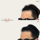 TMW 탈모왕수원 이미지