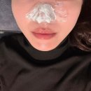 강남한의원 | [후기] 강남한의원 새살침 2회차 코모공시술 가격