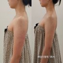 신월동206 | [공지] 신월동 웨딩 신부관리 상위 1% 비비 에스테틱 서울 신월 본점