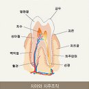 잇몸질환 예방약 필요없는 솔방울과 옥수수대 비법 이미지