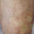 미소로한의원 이미지