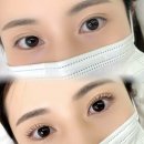 어니미즈 | [울산/남구] 울산남구 듀얼 언더펌ㅣ어니미즈