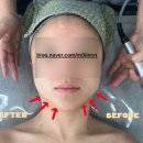 고잔동 603~고잔동 610 주변 | 안산 고잔동피부관리ㅣ더맑은에스테틱ㅣ고객맞춤 커스텀시술 후기(물방울리프팅, 고주파 써마젯리프팅)
