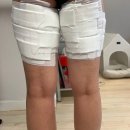 수의원 | 상상하던 라인을 경험할 수 있는 의원에서 지방분해주사 체험 후기 1회차