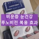 브로PC | 루노비전 비문증 개선 침침한 눈에 효과 어떨까 복용후기 먹는방법