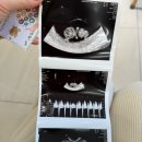 강선영산부인과