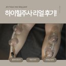 하이힐 | 종아리하이힐주사 리얼 후기! 매끈한 다리 라인과 무릎살 정리까지 한 번에