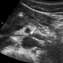 호두까기 이미지