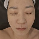 일성메디칼 | 부산 연산동 피부관리 리하에스테틱 레이저시술 후 재생관리 후기