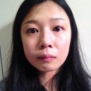 내손치과의원 네이버블로그