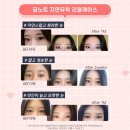 노트성형외과의원