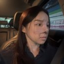 한장한코 | 기능 코성형 후기, 내돈내산 만성 비염 수술후기 (4일차~7일차)