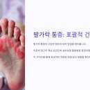 🦶발가락 통증 실비보험 적용 총정리