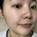 (주)메디바이오템 | 피부 독소 빼주는 SOS 응급 메디팩 | 피부관리 내돈내산 후기