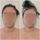 온바디 | 청주 율량동 윤곽관리 잘하는곳 온바디 에스테틱 프리미엄 관리 후기