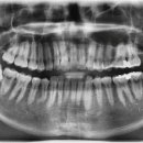 이하루치과의원 이미지