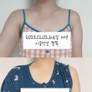 닥터쁘띠의원 | 내돈내산 정량 지방분해주사 1 - [ 건대 닥터쁘띠의원 ]