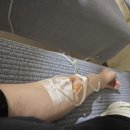 선이비인후과의원 | 혈관 안 보이는 편인데 주사 하나도 안 아팠던 곳 (쌍용동 이비인후과 후기)