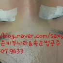 고운피부나라