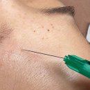 셀리올리스킨랩 정자점 | 분당편평사마귀레이저 셀리올리스킨랩 정자점 후기 CELLIOLY SKINLAB