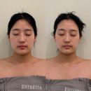 세븐일레븐 부산마린시티자이점 | [부산 에스테틱] 해운대윤곽관리 추천! 에스테티아 마린시티점 방문 후기💆‍♀️