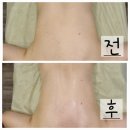 천안 불당동피부관리 허니스킨앤바디 등관리 테라노바 후기