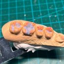 설 치과기공소 이미지