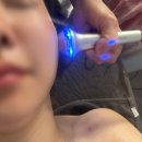 혜민약국 | 포항 미라인 스킨에어 볼뉴업스페셜 윤곽관리 받고 온 솔직후기 (리프팅 효과 대박)