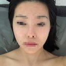 뉴인천빌딩 | [인천/주안] 예비신부 웨딩관리 추천 가성비 좋은 뉴벨라 에스테틱