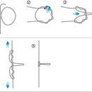 다운샷 매듭법 이미지