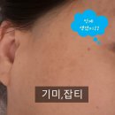 더진심 | 미아 진심테라피 후기, 목 승모근 마사지 피부관리 안티에이징