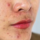 엘리피부과의원 이미지