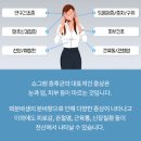 자가면역 쇼그렌증후군 및 (구강건조증, 입마름 원인) 이미지