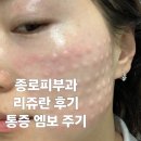 멍드리아 | 종로피부과 명동 리쥬란 2cc 1주일 후기 | 리쥬란힐러 통증 엠보 주기 효과