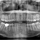 더바른윤치과의원 이미지