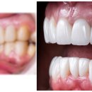 훈치과기공소 이미지