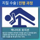 그린항외과의원 | 당신의 (X)는 안녕하신지? -#2 D-Day (항문농양/치루 수술, 안양 그린항외과)