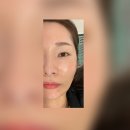 강저로 | 제천피부관리 에스테틱 은겸｜모공리프팅 에르모듀 솔직 체험후기