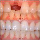 닥터뷰티치과병원 | 의정부 닥터뷰티치과병원, 3가지는 꼭 약속하겠습니다 <최용석 대표원장>