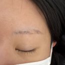 세븐일레븐구미구평행복점 | 구미 눈썹 잔흔 제거 잘 하는 곳 [오브유]