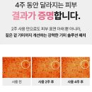 (주)마이크로컨텍솔루션 | 🟦 아르페 다크스팟 기미 잡티 마이크로팁 네모 패치 리뷰 &amp; 정보 총정리