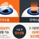 누리안과의원 | 대전안과병원, 라식·라섹 후회하지 않으려면 '이것'부터 보세요 - 보다안과 21년 차 전문의