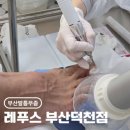 꼬지와친구들 덕천점 | [부산발톱무좀] 축구광 남자친구의 무좀탈출을 위한 레푸스부산덕천점 스케일링 후기