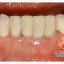 수플란트치과병원 이미지