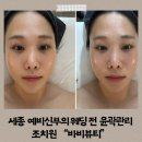 조치원_삼일아파트 | 세종 예비신부의 웨딩 전 윤곽관리 조치원 &#34;바비뷰티&#34;